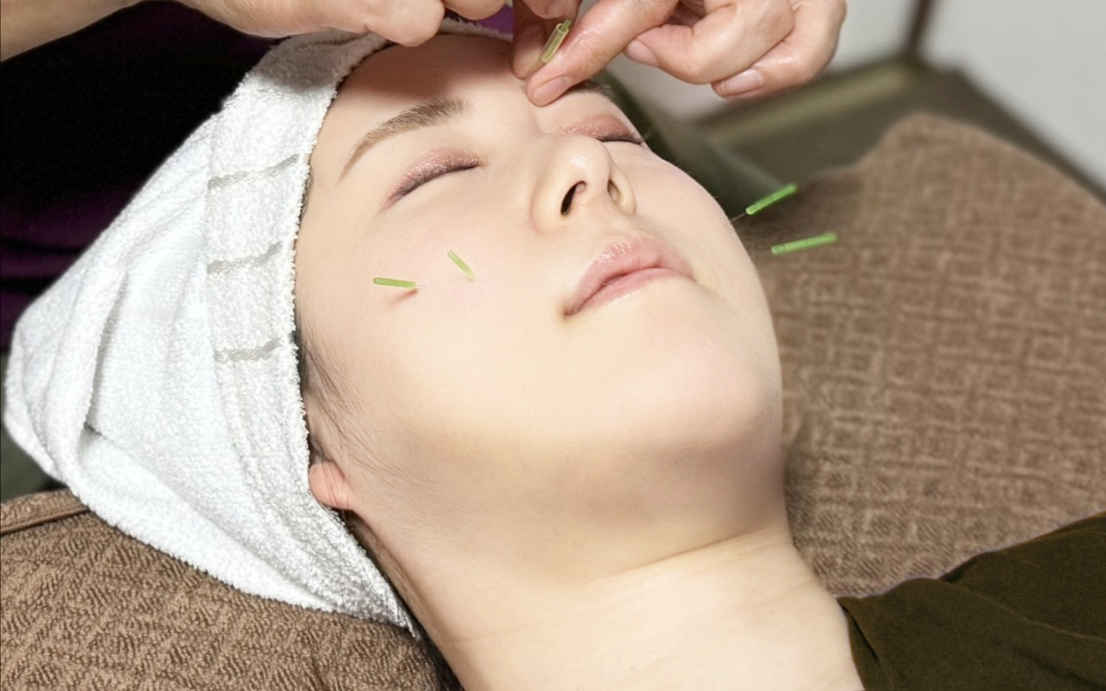 女性鍼灸師による施術