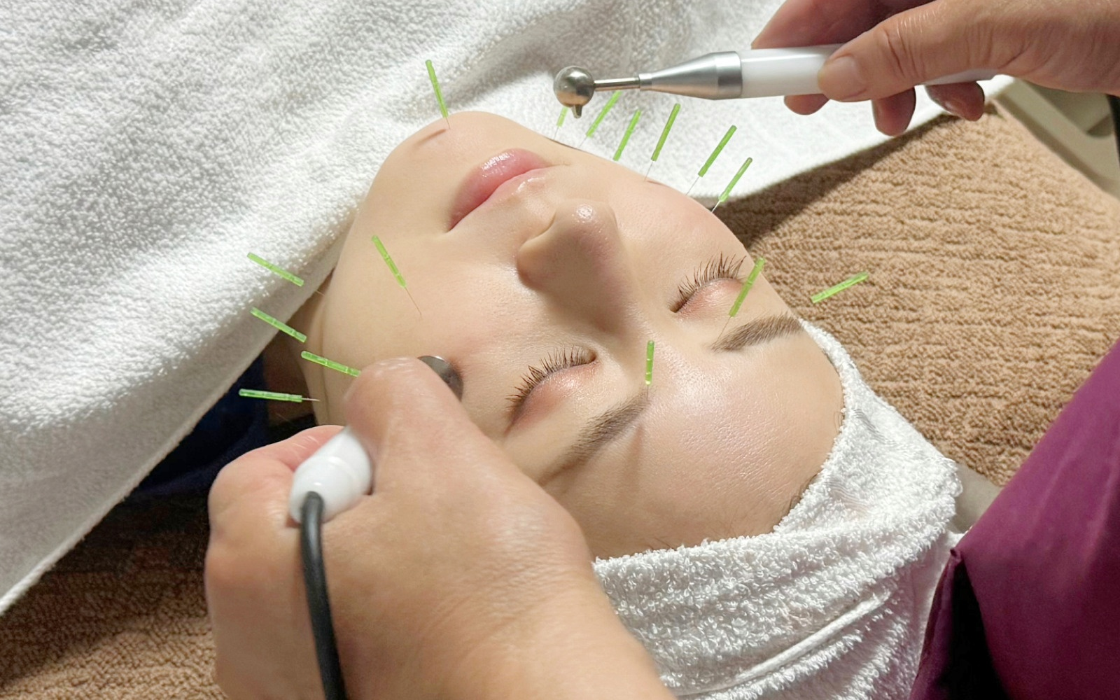 美容鍼＋AURA JrⅡ